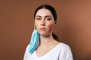 Fungal Acne | Dermatology Group of the Carolinas