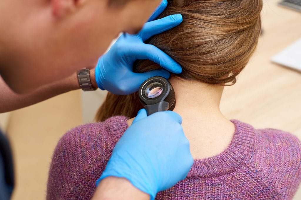 Skin Cancer check